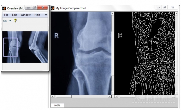 Kompiuterinė nuotraukų analizė