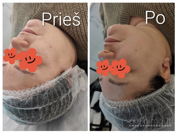 Kūno formavimo ir stangrinimo procedūros MAŽESNĖMIS KAINOMIS KAUNE!!!