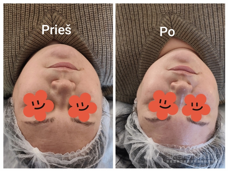 Kūno formavimo ir stangrinimo procedūros MAŽESNĖMIS KAINOMIS KAUNE!!!