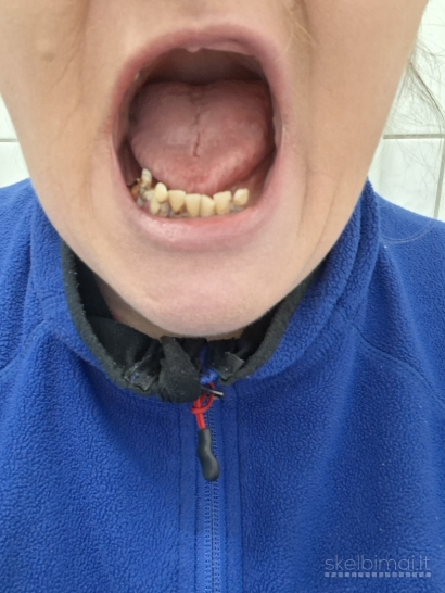 Pagalbos prasymas del operacijos